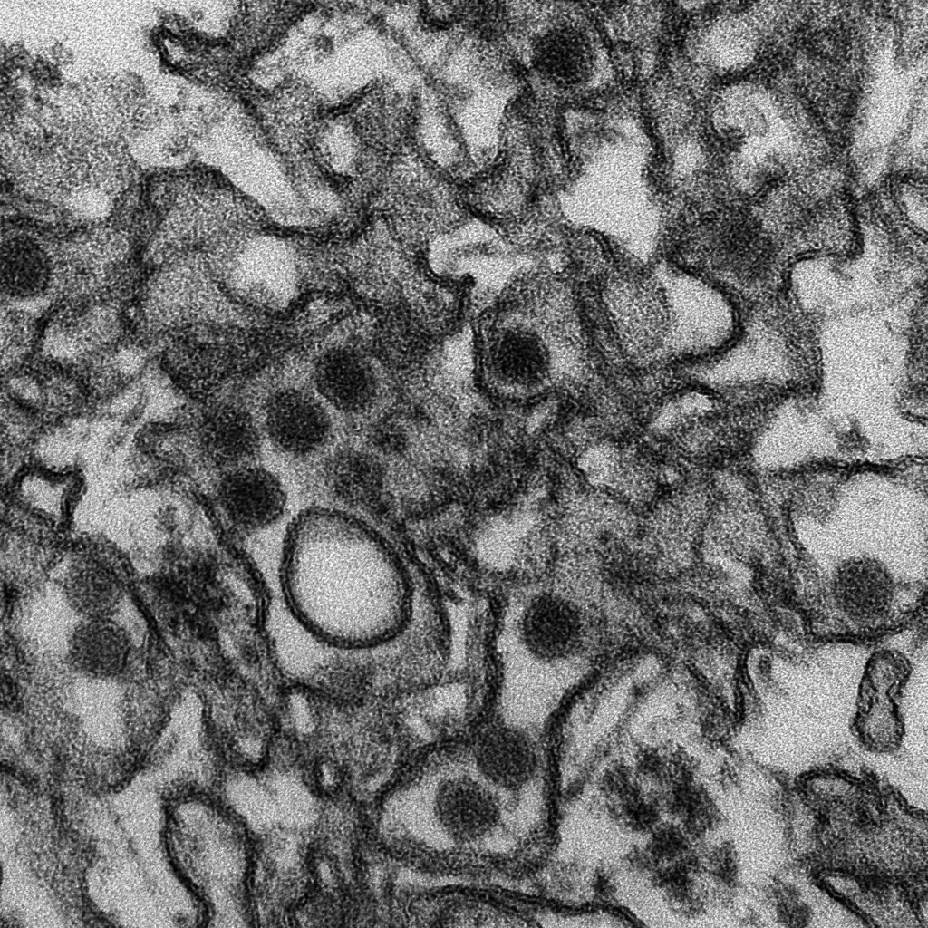 Electron micrograph of Zika virus
